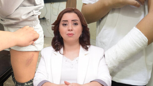 Məktəbdə xəsarətlə nəticələnən münaqişə valideyndən GİZLƏDİLDİ