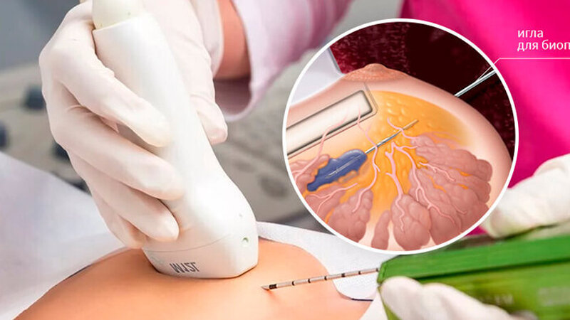 Alimlər tibbdə ən ağrılı diaqnostik metodu əvəz edəcək yeni üsul tapdı