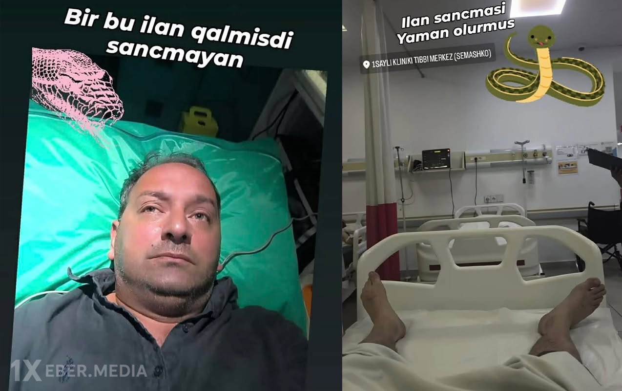 Elnur Kərimovu ilan sancdı - Foto