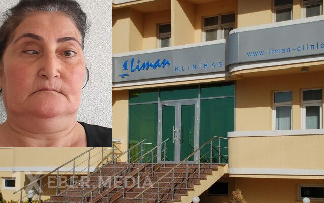 “Liman Klinikası”nda burun əməliyyatından sonra xəstənin gözü çəpləşib